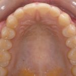 Top View of Teeth