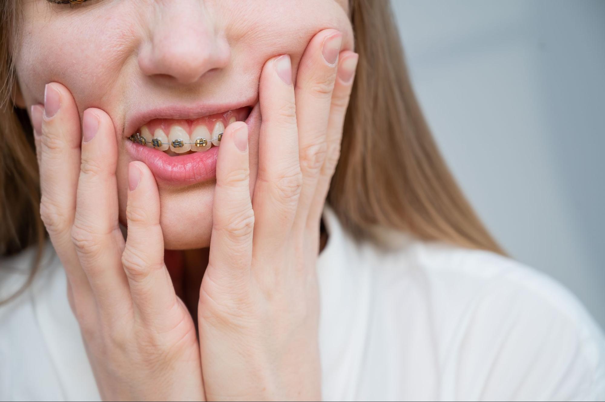 Common Braces Issues and How to Handle Them